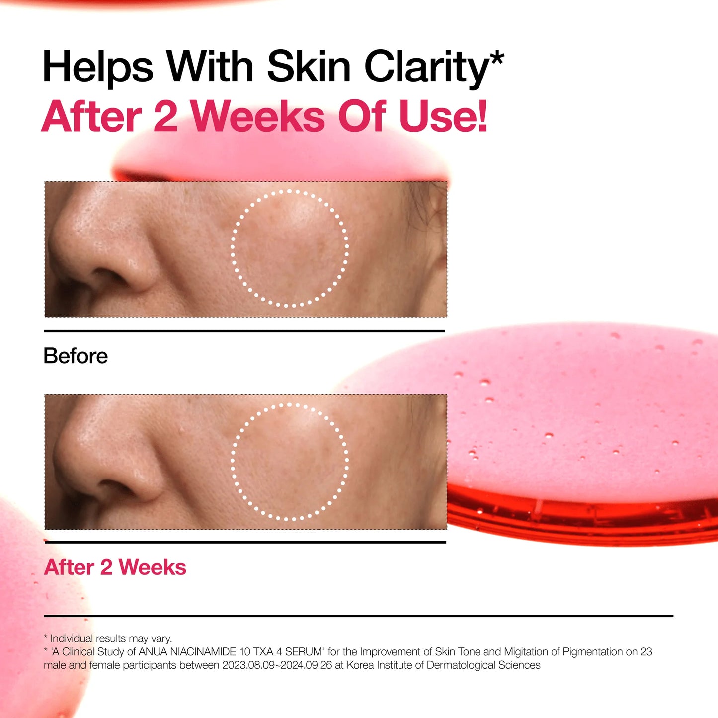 Anua NIACINAMIDE 10%+TXA 4% Dark Spot Serum